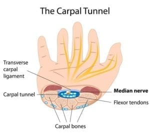 Illustrasjon carpaltunnel anatomi