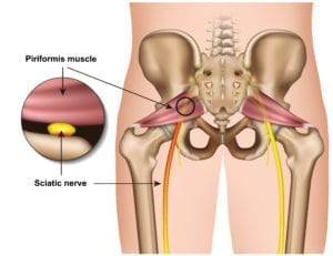 Anatomisk illustrasjon bekkenet og pirifromismuskelen